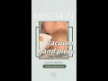 Lagu RF neck-care treatment | Melbourne facial｜customise the treatment plan for you｜MINTSKIN clinic