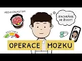 Download Lagu OPERACE MOZKU