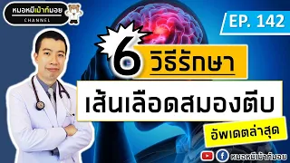 วิธีรักษาเส้นเลือดในสมองตีบข้อแรกคืออะไร?