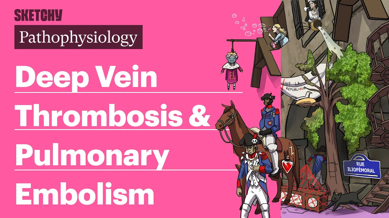 Deep Vein Thrombosis & Pulmonary Embolism (Pathophysiology) | Sketchy Medical