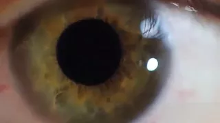 الحصول على عيون خضراء أسرع للغاية في 18 ثانية 