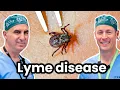 Lyme Disease and Ticks - Causes Treatments and More