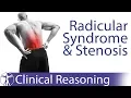 Download Lagu Lumbar Radicular Syndrome vs. Intermittent Neurogenic Claudication/Stenosis
