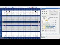 Charting Furcations and Mobility in Dentrix