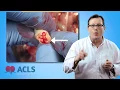 Neonatal Resuscitation Algorithm