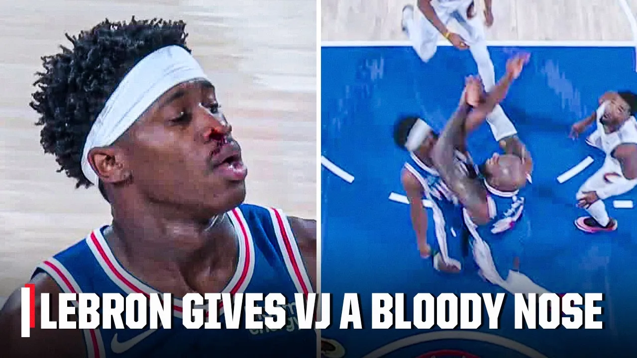 LeBron accidentally hits V.J. Edgecombe in the face giving him a bloody nose | NBA on ESPN