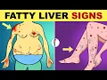 Download Lagu Fatty Liver Symptoms | Early Signs of Fatty Liver Disease | Non Alcoholic Fatty Liver Disease