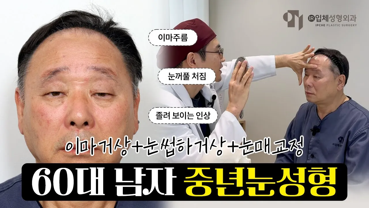 60대중년 눈꺼풀처짐 해결! 👉🏻이마거상, 눈썹거상, 눈매교정 수술👈🏻