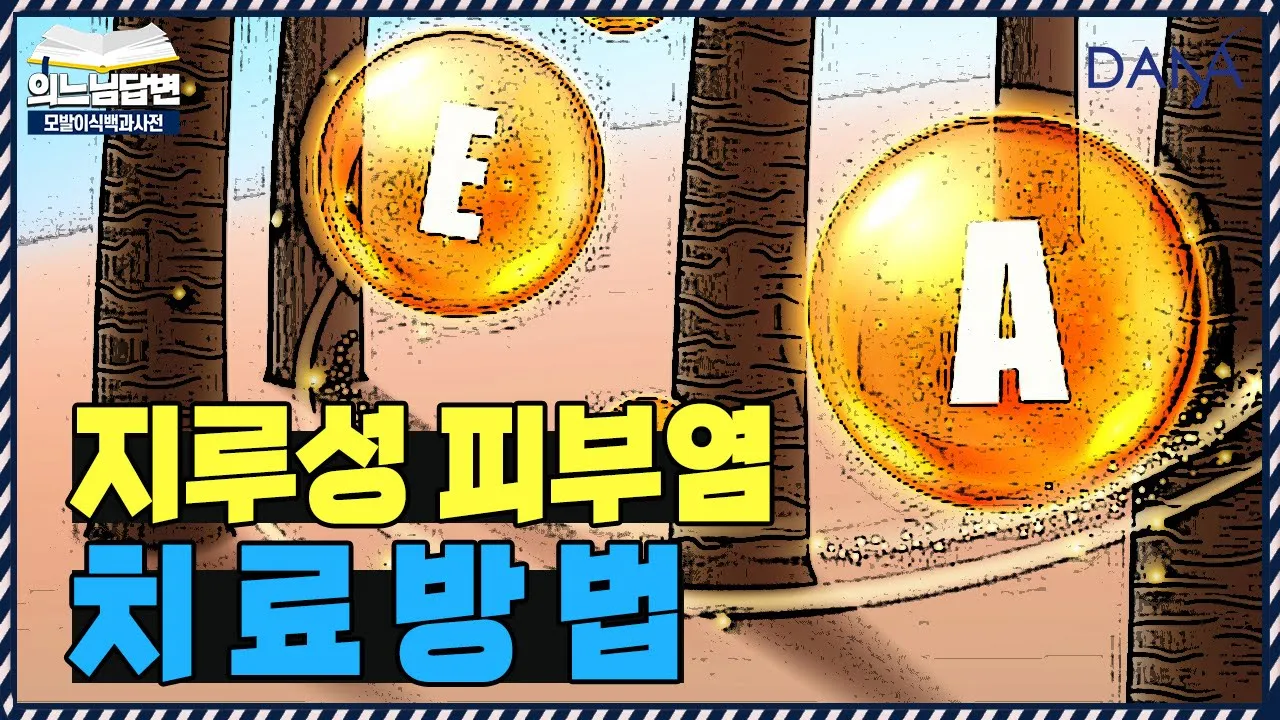 의느님답변📂지루성 두피염, 증상 및 치료방법ㅣ지루성 두피염의 모든것②ㅣ다나성형외과(DANA)ㅣ모발이식ㅣ헤어라인교정ㅣ두피문신ㅣ탈모치료