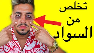 تخلص من السواد تحت العين دندنها