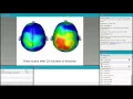 FIZIKA WEBNAR SERIES Action Based Learning