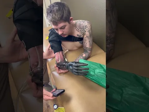 they are making me an arm..