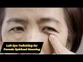 Left Eye Twitching for Female Spiritual Meaning