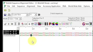 How to extract Consensus Sequence by using BioEdit - Use for better experience