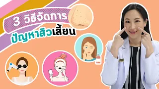 สิวเสี้ยนบริเวณจมูกเกิดจากอะไร และรักษาอย่างไรให้ดีที่สุด