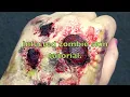 Infected Zombie Skin Tutorial!