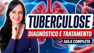 Tuberculose (Aula completa) - Profa. Juliana Mello