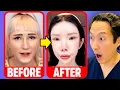 The Internet Says Lisa Yo is Asian-Fishing Here s What I See as a Plastic Surgeon
