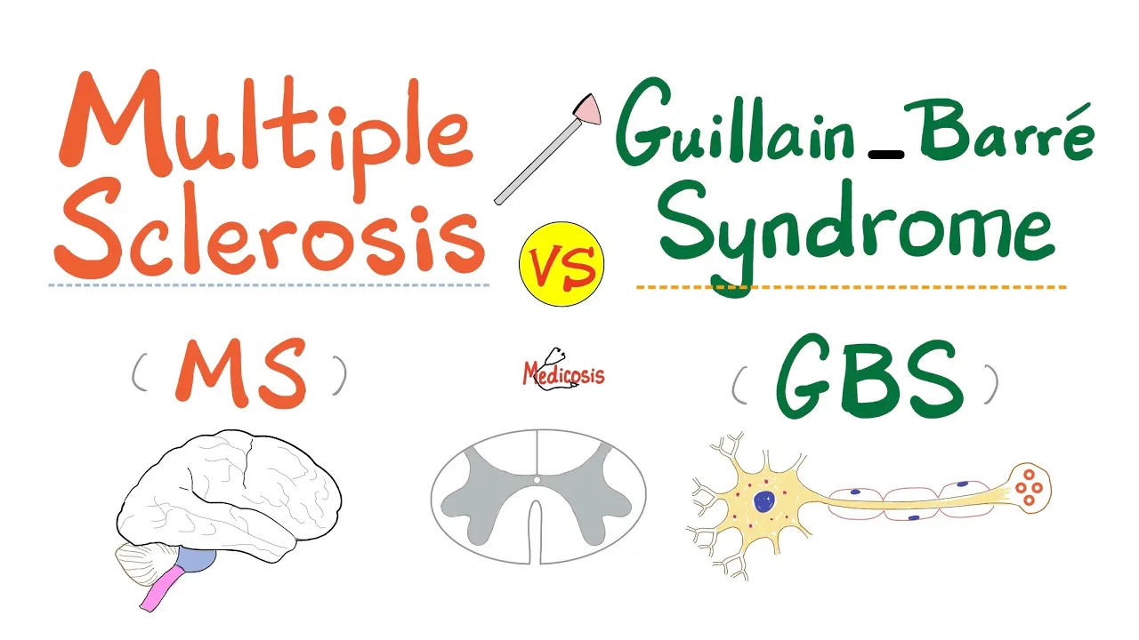 Multiple Sclerosis (MS) vs. Guillain-Barré Syndrome (GBS)- Causes, Symptoms, Diagnosis & Treatment