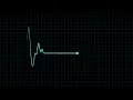 Download Lagu Animasi Detak Jantung #Part 1 (Heart Pulse) No Copyright