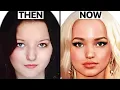 Dove Cameron s NEW FACE Plastic Surgery Analysis