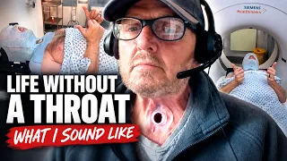 I Had My Throat Removed to Survive Cancer - What I Sound Like Now