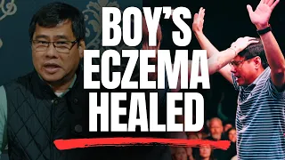Son Healed of Eczema Through the Screen