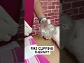 CUPPING THERAPY