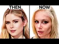 Erin Moriarty The Boys NEW FACE Plastic Surgery Analysis