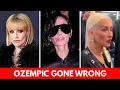 35 Celebs With Ozempic Face Before and After I You d Never Recognize Today