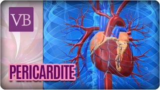 Pericardite: Inflamação do Pericárdio - Você Bonita (21/02/17)