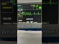 What is the rhythm EP 1