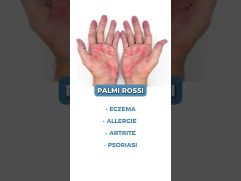 ποΈ Le tue mani ti stanno dicendo qualcosa sulla tua salute (ascoltale)
