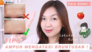 Download Cara Mengatasi Bruntusan Secara Alami ala Desty || Desty Yufenti MP3