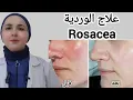 Download Lagu علاج الوردية نهائيًا في الوجه/أسباب الروزيشيا/أعراض الروزيشيا/علاج احمرار الوجه/الورديه و العدالوردي