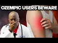 10 Surprising Ozempic Side Effects You re Not Prepared For Doctor Explains