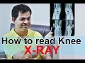 Learn to read X-ray Online Meaning Of X ray HINDI Knee x ray reading Knee Osteoarthritis X ray