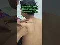 Lagu TERAPI PIJAT SAKIT BELIKAT MENJALAR KE PUNDAK DAN LEHER #massage #pijaturatjakarta