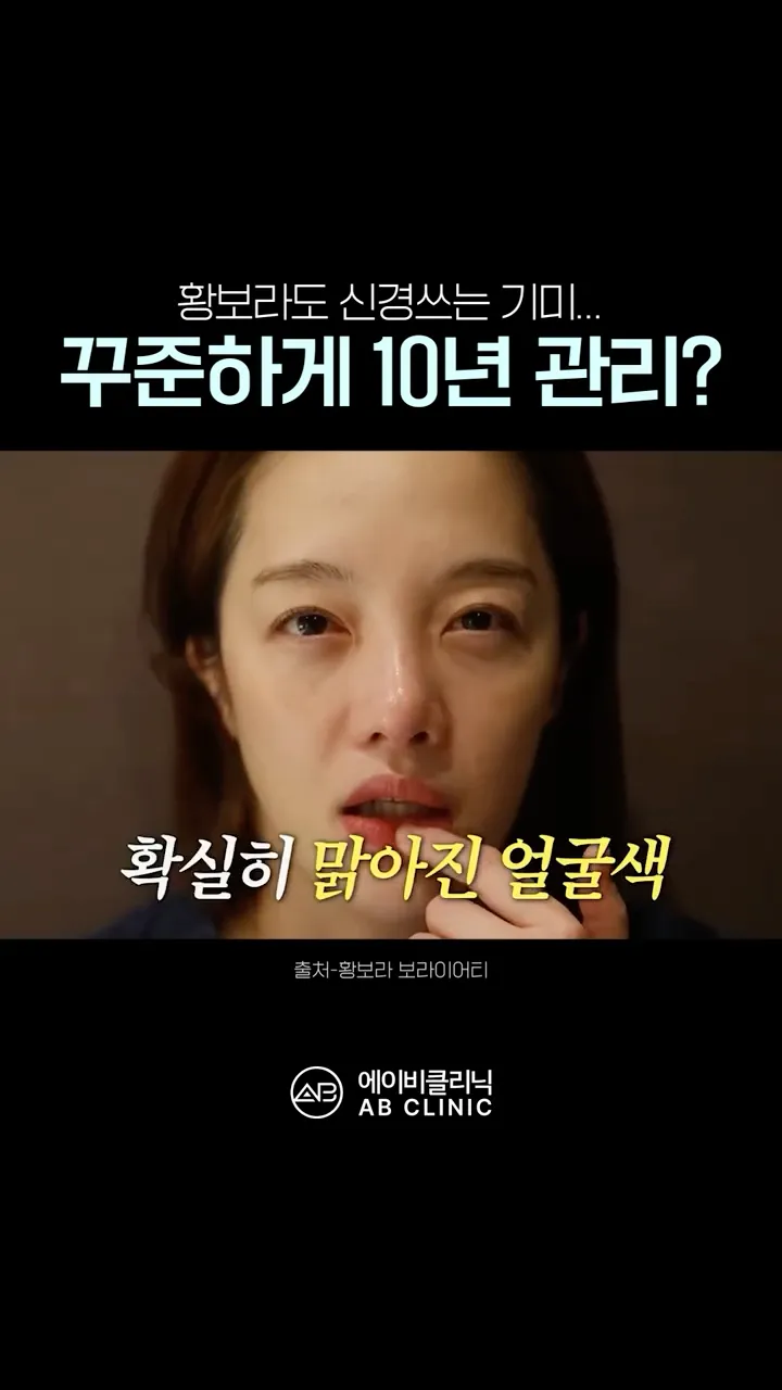배우 황보라의 기미 관리 비법
