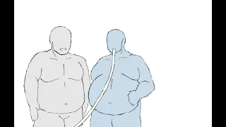 Weight Gain Animation 3