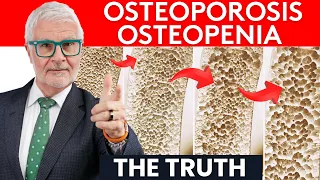 Dr. Gundry Reveals The Truth About Osteoporosis / Osteopenia Symptoms