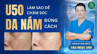 LÀM SAO ĐỂ CHĂM SÓC DA NÁM ĐÚNG CÁCH Ở TUỔI U50 ? | Đào Ngọc Anh { Thẩm Mỹ }