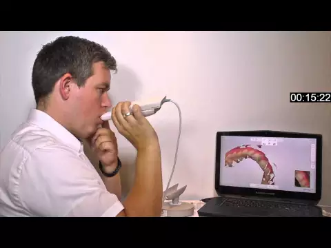 Video thumbnail: Speed-scanning with the 3Shape TRIOS 3 intraoral scanner