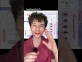 Pregnancy and ACCUTANE