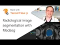 Radiological image segmentation with Medseg - Made with TensorFlow js