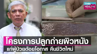 ทำไมโครงการคลังผิวหนังถึงสำคัญสำหรับผู้ป่วยที่ได้รับบาดเจ็บจากไฟไหม้หรือน้ำร้อนลวก และใครสามารถขอรับบริจาคผิวหนังได้