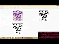 Detection and counting of blood cells using image segmentation A review