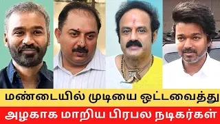 top actors acts with wig and hair transplant cinema secretz