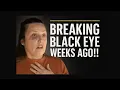 Download Lagu EXPLOSIVE! MUST WATCH! Rebecca Haro’s Mother Funeral Aug 5th – BLK EYE \u0026 NO EMMANUAL!