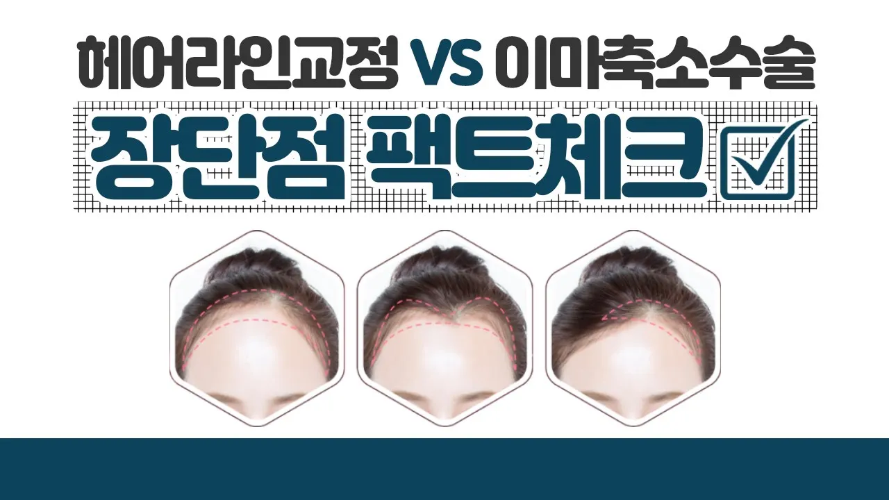 의느님답변📂ㅣ헤어라인교정vs이마축소수술 장단점 팩트체크